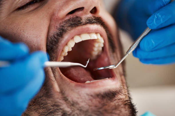 Best Knocked-Out Tooth Emergency  in Bridgeport, MI